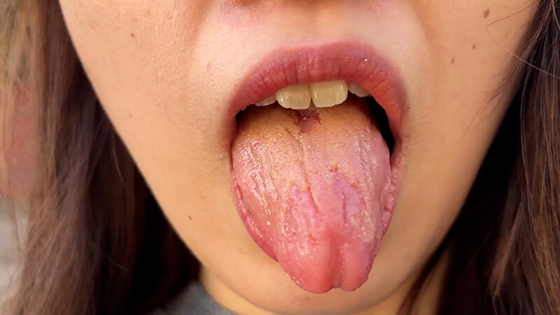 h_1651nko00003 sample 1