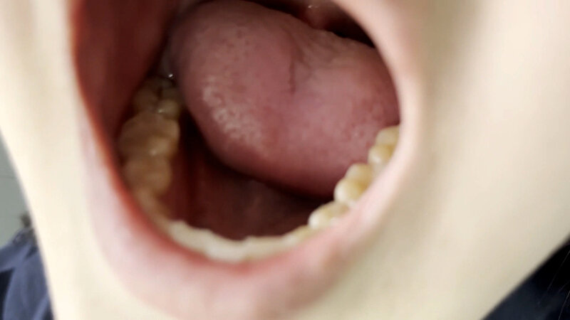 h_1651nko00003 sample 5