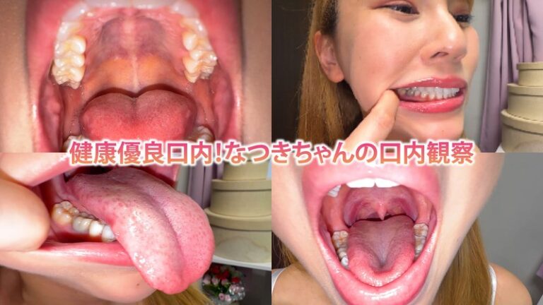 健康優良口内！なつきちゃんの日内観察