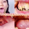 ガチャ歯フェチ必見！高藤なほのちゃんの口内観察